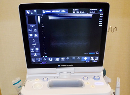 超音波診断装置